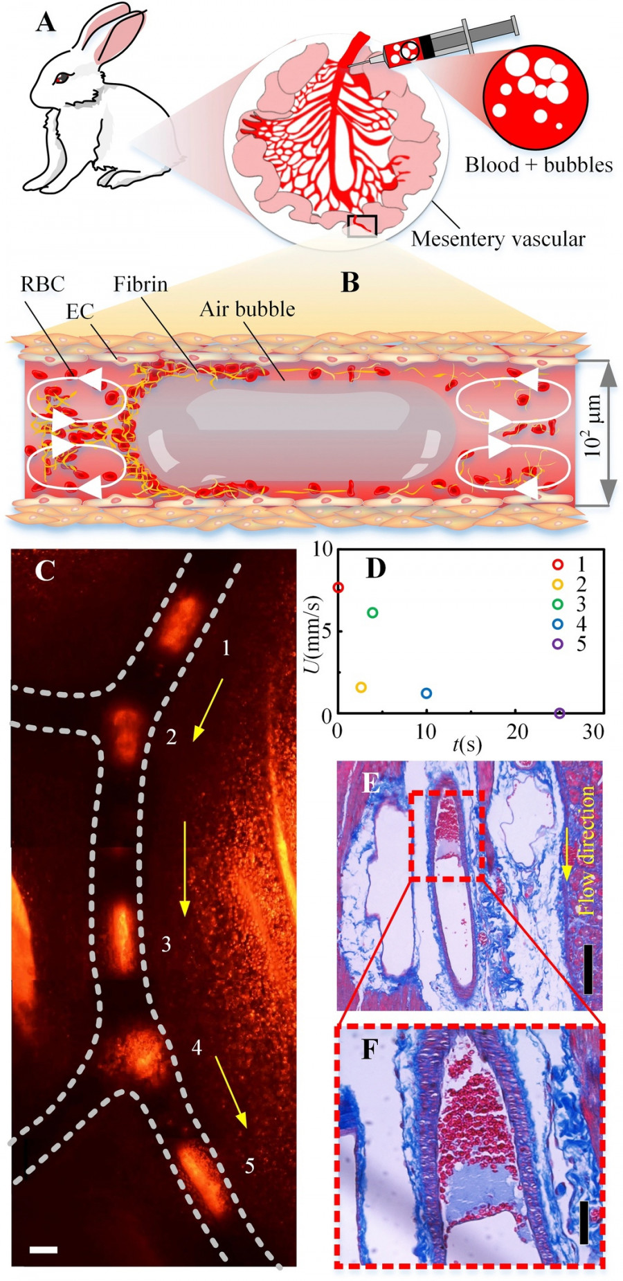 Эксперимент in vivo по формированию воздушной эмболии в брыжеечных сосудах кролика. (А) Схема эксперимента in vivo. (B) Схема пузырька, заключенного в сосуд. (C) Процесс остановки пузырька, протекающего в небольшом сосуде. Красный цвет — это отражение света от поверхности пузырька. (D) Скорость пузыря в точках от 1 до 5, отмеченных на изображении C. (E) Гистологический срез воздушного эмбола, взятый из сосуда вдоль направления потока. (F) – сгусток кровяных телец, образовавшийся в хвосте пузыря.
